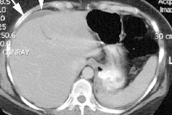 CT_leak1_sm.JPG (18609 bytes)