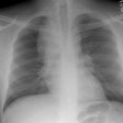 Cxr97