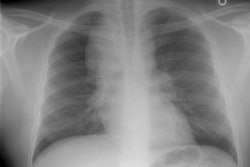 Cxr97