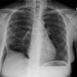 Cxr Small