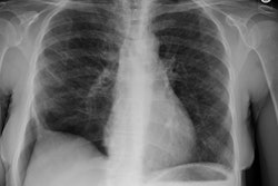 Cxr Small