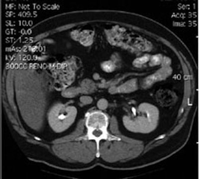Case1_CT_sm.JPG (21666 bytes)