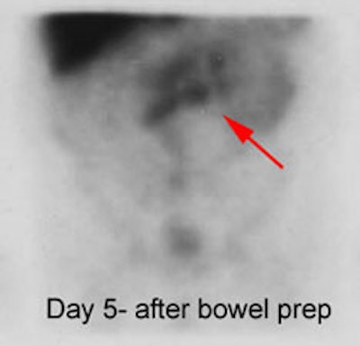 Case1_Delayed.JPG (10774 bytes)