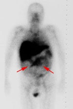 Case1_WB.JPG (7530 bytes)