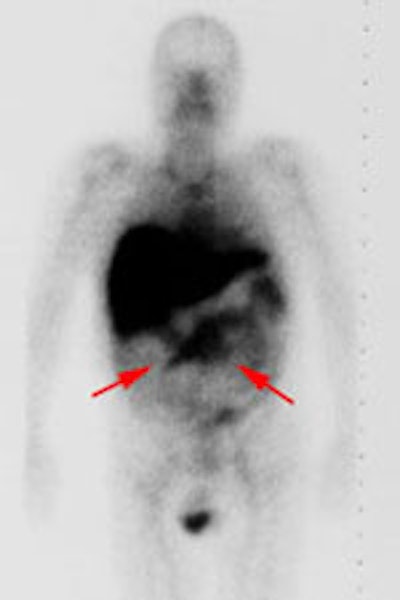 Case1_WB.JPG (7530 bytes)