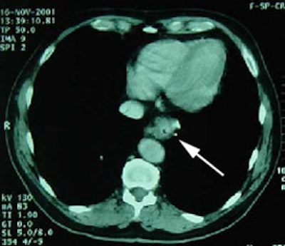 Case2 Ct