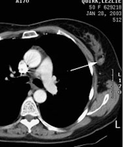 Case2 Ct1