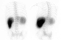 Colloid_shift1.JPG (6016 bytes)