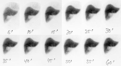 Commonduct_HIDA.JPG (16679 bytes)