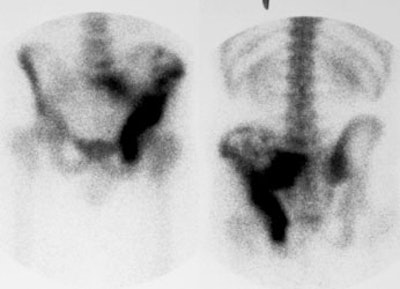 Ewings_BS.JPG (17193 bytes)