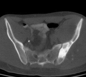 Ewings_CT.JPG (11957 bytes)