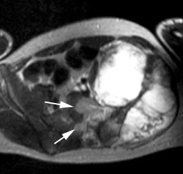 Ewings_MR.JPG (17389 bytes)