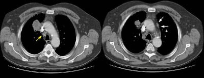 False Pos N2 N3 Nodes S