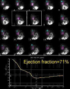 Gbef.jpg (44795 bytes)