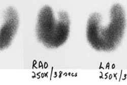 Graves.JPG (16119 bytes)