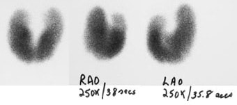 Graves.JPG (16119 bytes)