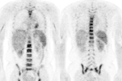 Growth Colony Effect