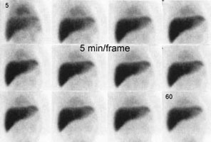 HIDA1_early_sm.JPG (15565 bytes)