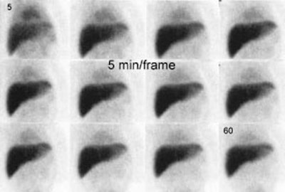 HIDA1_early_sm.JPG (15565 bytes)