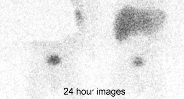 HIDA1_late.JPG (18564 bytes)