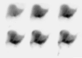 HIDA_Leak1.JPG (6913 bytes)