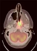 HN_axial.JPG (11114 bytes)