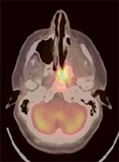 HN_axial.JPG (11114 bytes)