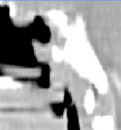 HN_cone.JPG (8752 bytes)