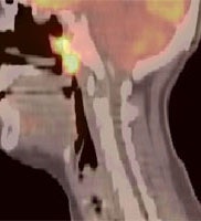 HN_sag.JPG (11423 bytes)