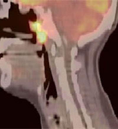 HN_sag.JPG (11423 bytes)