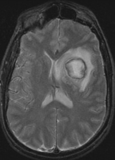 Head MR crop.JPG (40722 bytes)