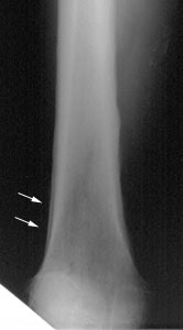 Hoa.jpg (8194 bytes)