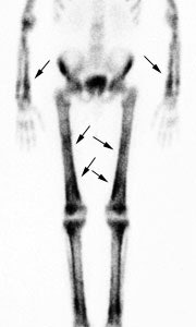 Hoa_bs.jpg (12096 bytes)