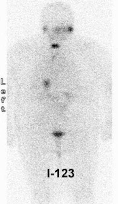 I 123 Neg2