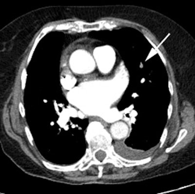Intermed Ct2
