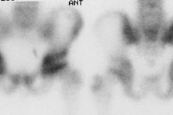 Lcp_bs.jpg (11975 bytes)