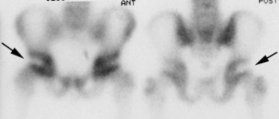 Lcp_bs.jpg (11975 bytes)