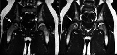 LCP_MR_sm.JPG (23462 bytes)