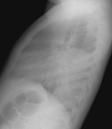 Lat small.JPG (24830 bytes)