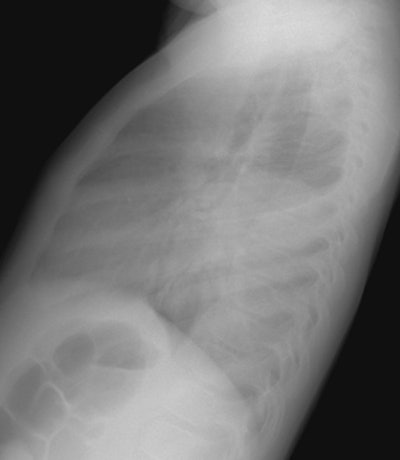 Lat small.JPG (24830 bytes)