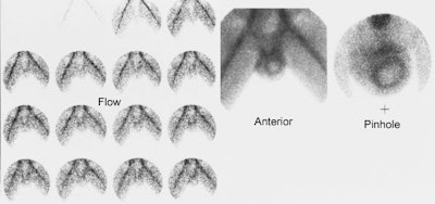 Late_torsion.jpg (36862 bytes)