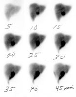 Leak2_HIDA.JPG (8441 bytes)