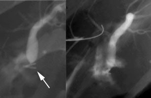 Leak2_perc.JPG (10810 bytes)