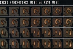 Mibi Crop