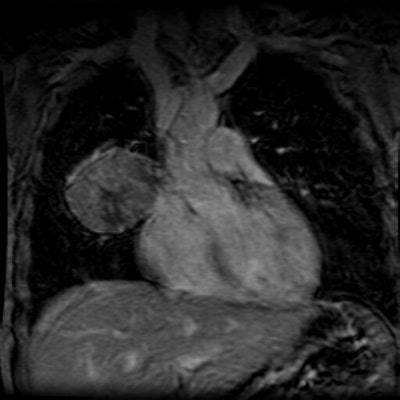 Mr Post Contrast Small