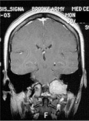 Mr1.jpg (17118 bytes)