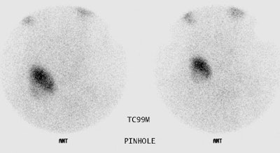 M L Two Months Post Rx Scan