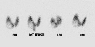 Marine Lenhart Pre Rx Scan