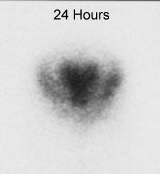 NPH_24_sm.jpg (8453 bytes)