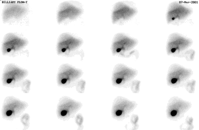 Normal_HIDA.jpg (34644 bytes)